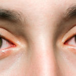 Collirio per occhi rossi e terapia anti-glaucoma