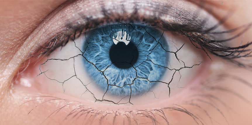 Al momento stai visualizzando Occhio secco: quando utilizzare un collirio lubrificante